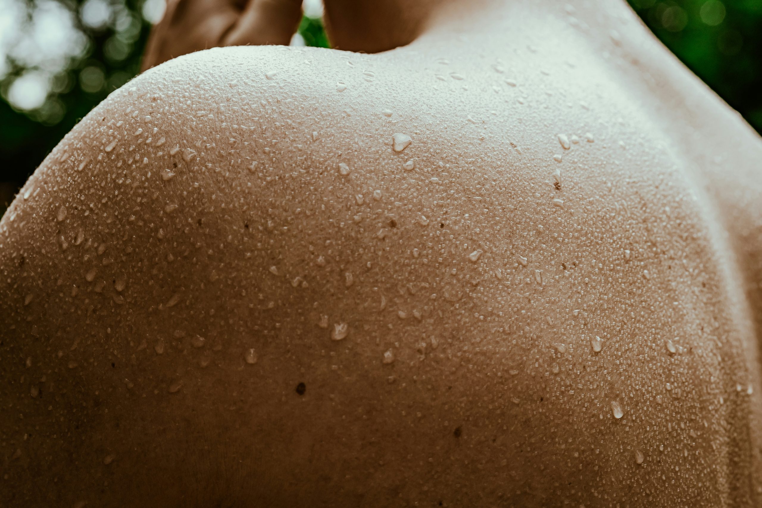 Woman experiencing night sweats with sweat beads on shoulder – Menopause symptoms