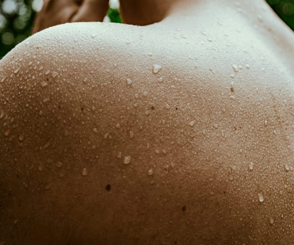 Woman experiencing night sweats with sweat beads on shoulder – Menopause symptoms